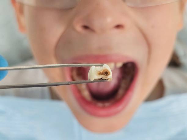 Best Emergency Treatment for Jaw Pain or Injury in Smithfield, VA